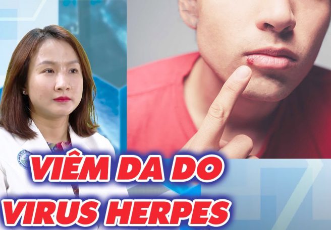 VIÊM DA DO VIRUS HERPES
